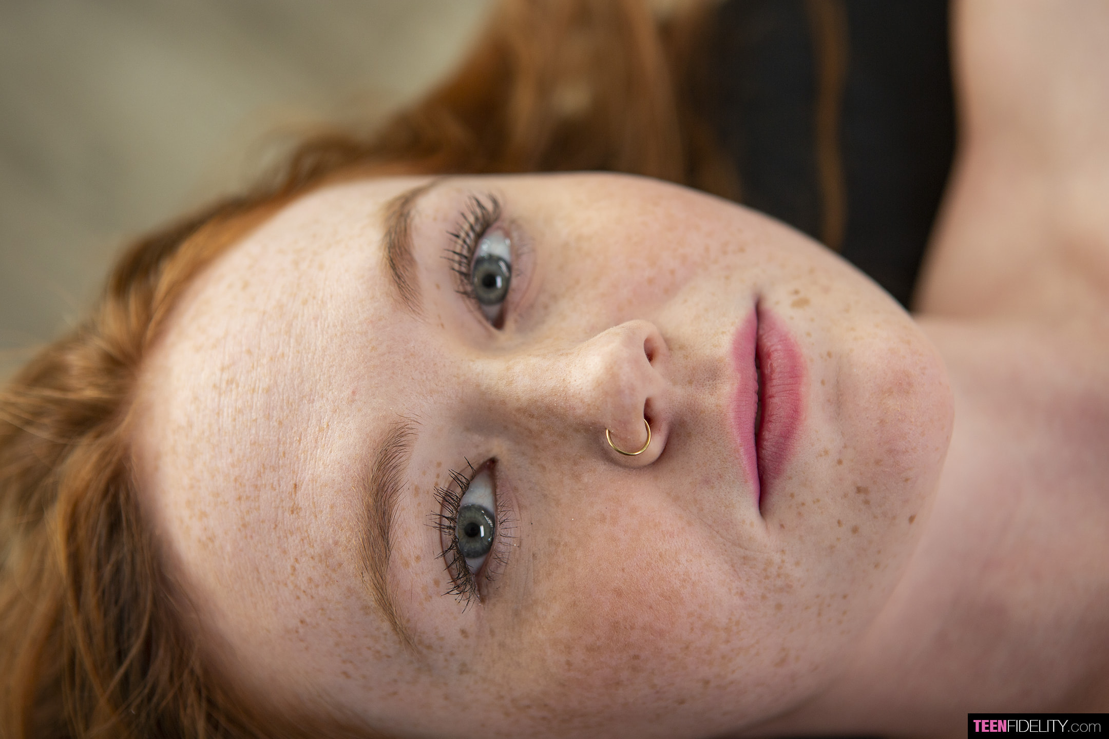 Fire and Freckles