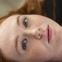 Fire and Freckles
